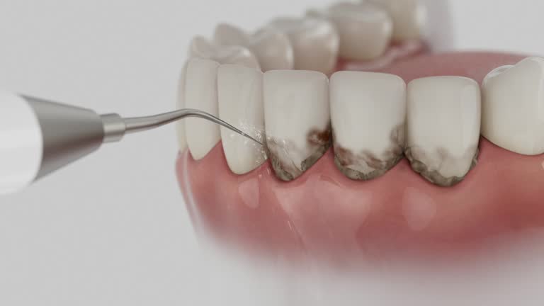 Trusted Teeth Whitening service in Clinton, TN - Dentist Open Now